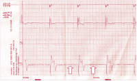 Abbildung 2: EKG