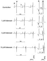 Abbildung 1: Wirkung von Adenosin