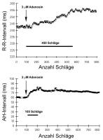 Abbildung 2: Wirkung von Adenosin