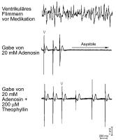 Abbildung 5: Adenosin - Theophyllin