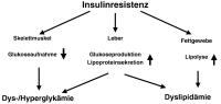 Abbildung 1: Insulinresistenz