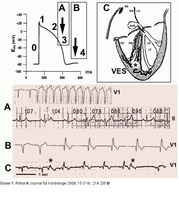 Funktioneller Schenkelblock