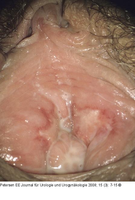 Kohabitationsverletzung