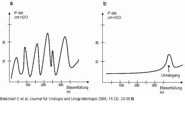Urodynamische Untersuchung