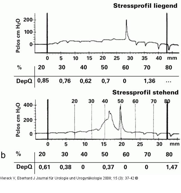 Introitussonographie
