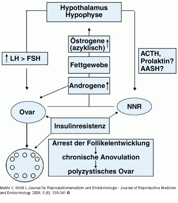 Hyperandrogenämische Ovarialinsuffizienz