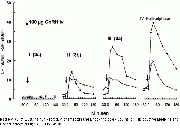 Hypothalamische Amenorrhö