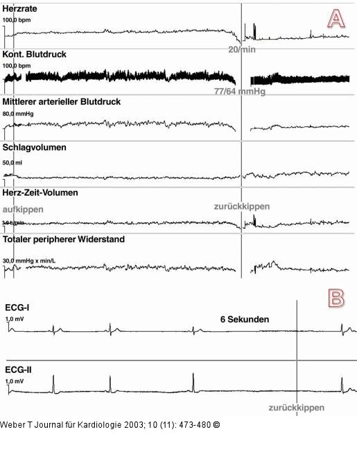 Kipptisch - Untersuchung