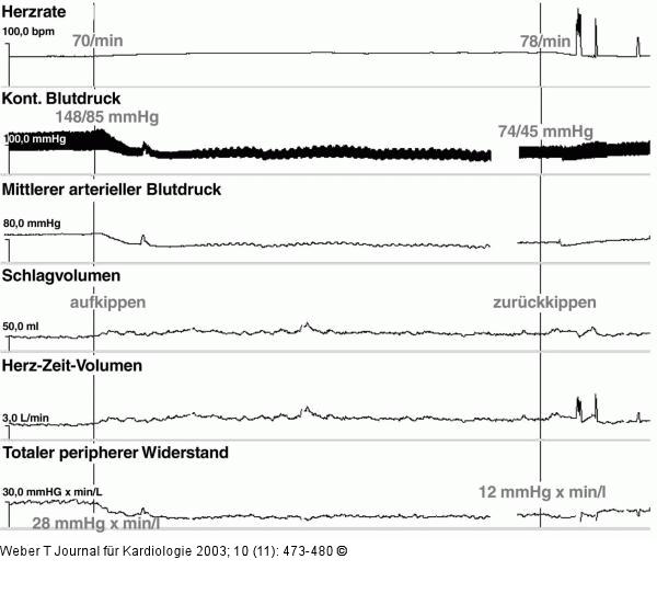 Kipptisch - Untersuchung