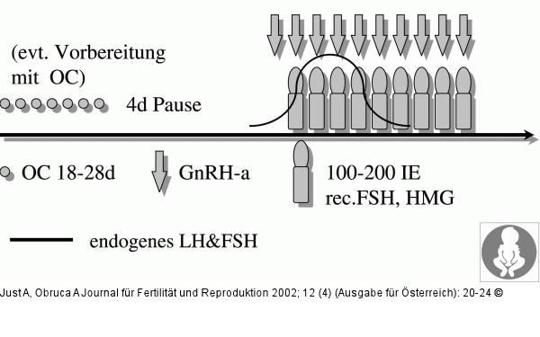 Ovarielle Stimulation - kurzes Stimulationsprotokoll