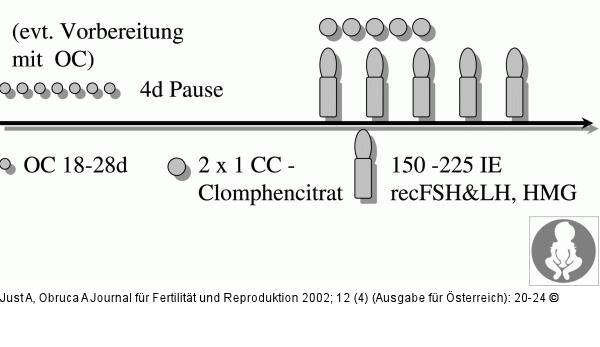 Ovarielle Stimulation - kombiniertes Stimulationsprotokoll