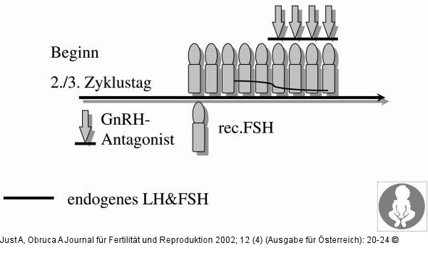 Ovarielle Stimulation - GnRH-Antagonist