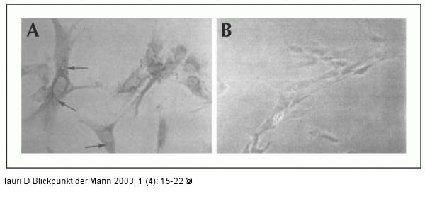Schwellgewebe - NO-Synthase-Abhängigkeit