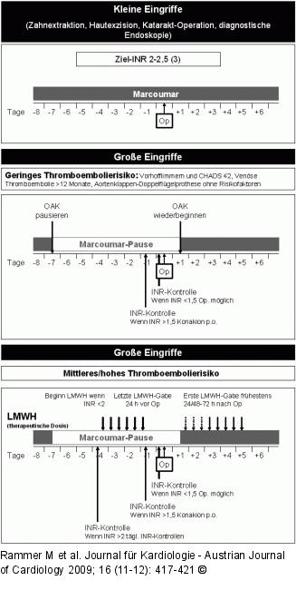 OAK - Perioperatives Management