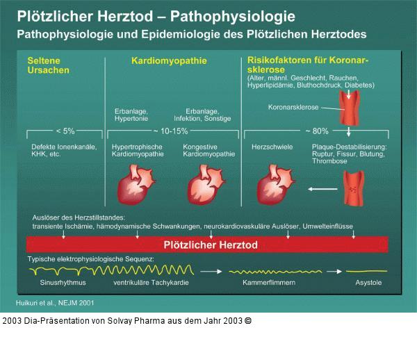 Plötzlicher Herztod – Pathophysiologie - Pathophysiologie und Epidemiologie des Plötzlichen Herztodes