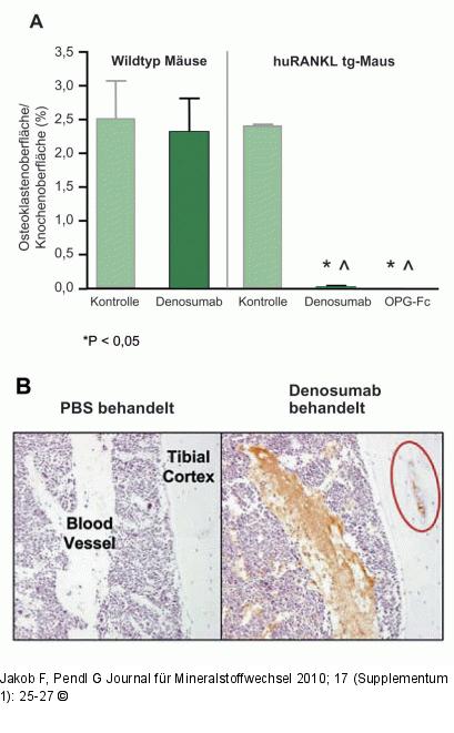 Denosumab - Effekt