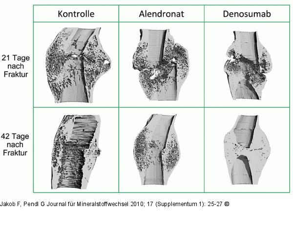 Kallusstrukturanalyse 