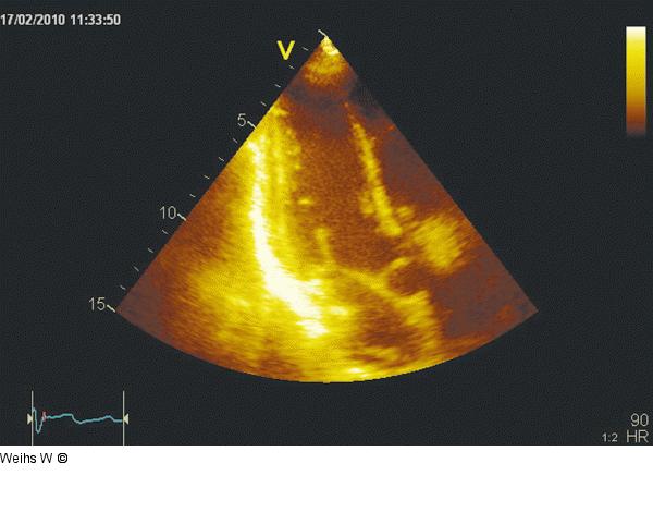 Apikaler Längsschnitt