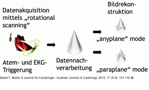 TEE - 3D-Echokardiographie