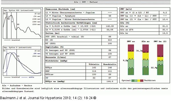 Pulswellen - Messung