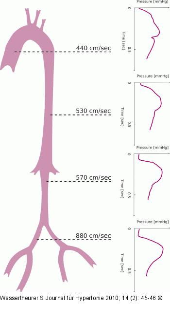 Pulswelle - Gefäßbaum