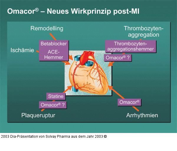 Omacor(R) – Neues Wirkprinzip post-MI