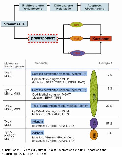 Karzinogenese - Kolon