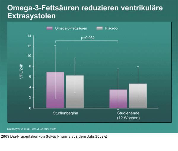 Omega-3-Fettsäuren reduzieren ventrikuläre Extrasystolen