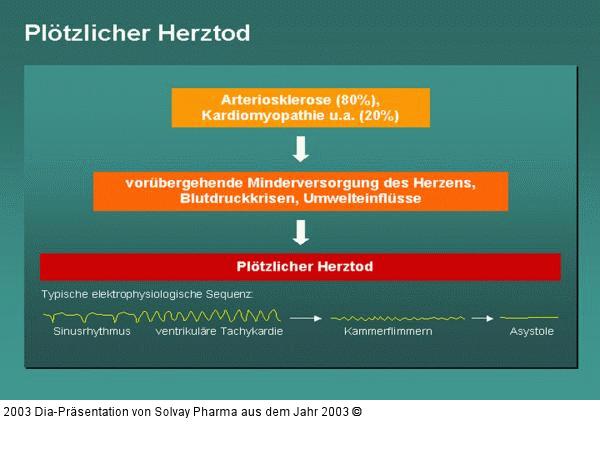 Plötzlicher Herztod