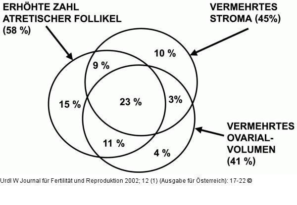 Polyzystisches Ovar-Syndrom - Ultraschall