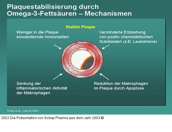 Plaquestabilisierung durch Omega-3-Fettsäuren – Mechanismen