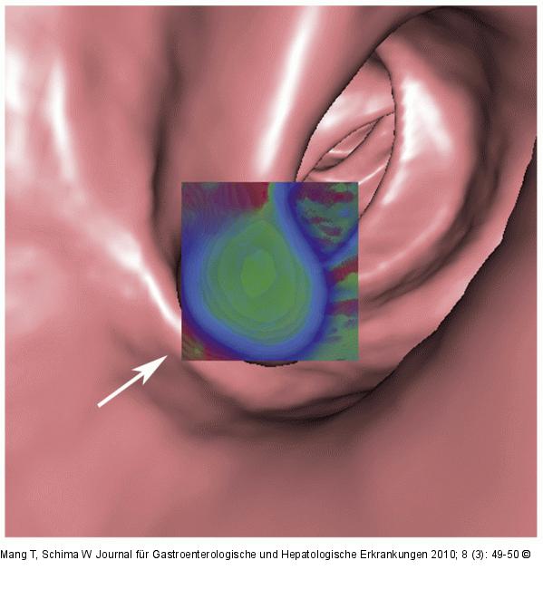Translucency rendering