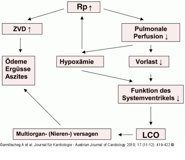 Pulmonaler Gefäßwiderstand