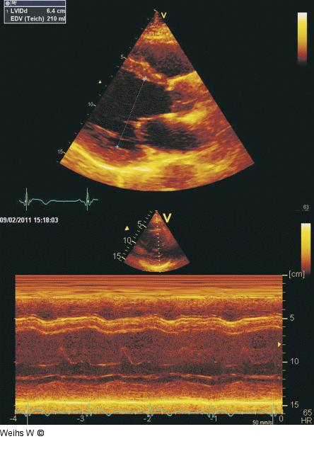 Parasternaler Längsschnitt - M-Mode