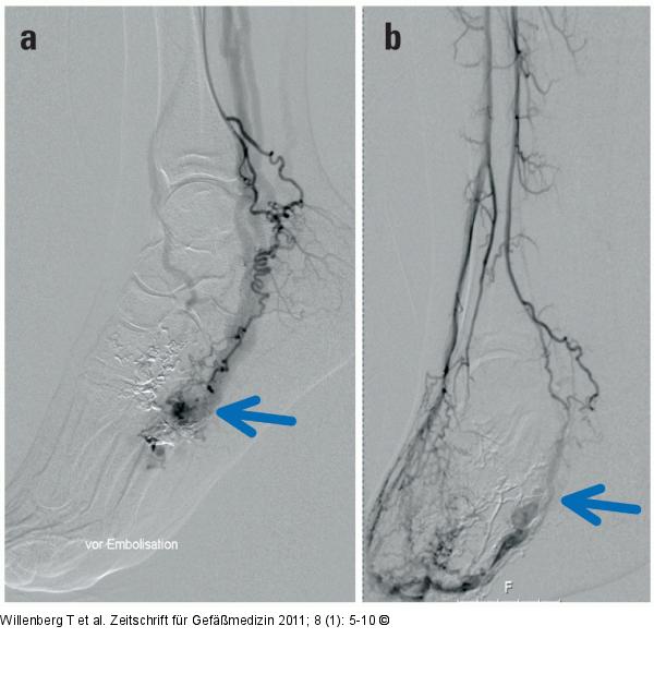 Angiographisches Bild