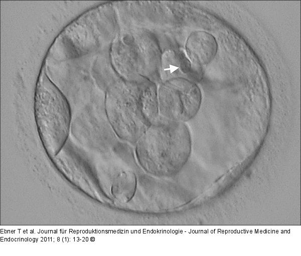 Blastocyst