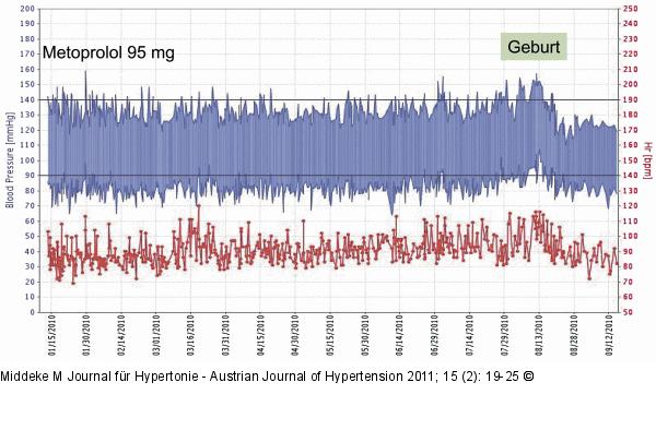 Verlauf - Blutdruck - Pulswert