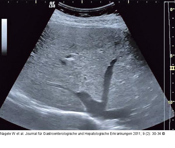 Ultraschall-Abschlussbild