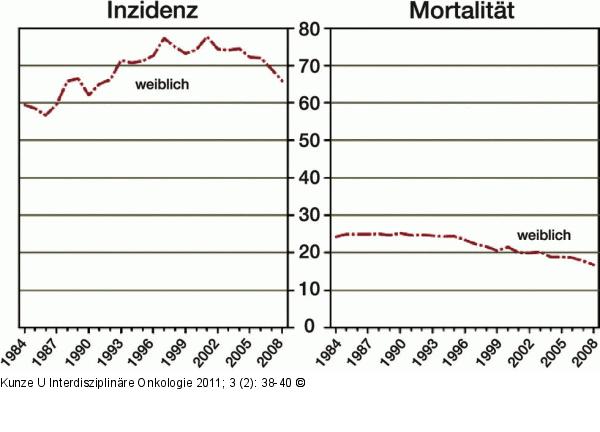 Bösartige Neubildung der Brust im Zeitverlauf