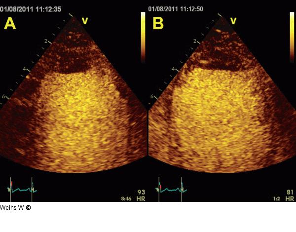 Längsschnitt - Vierkammerblick