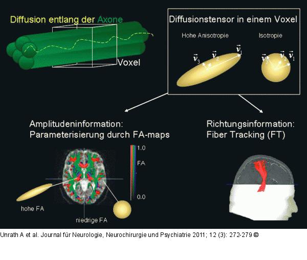 Anisotrope Diffusion