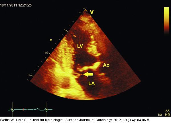 Apikaler Längsschnitt