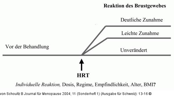 Hormonersatztherapie - Brustgewebe