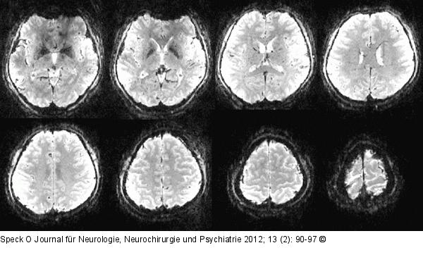 Single-shot-Echo-Planar