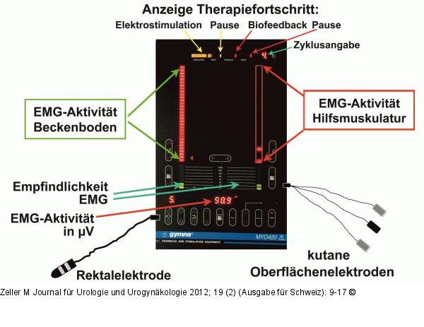 Trainingsgerät Myo 420®