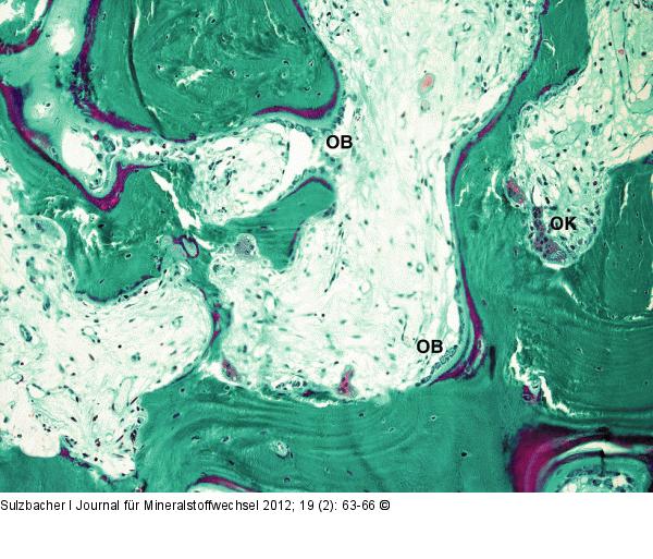 Lamellenknochen - Osteoblasten