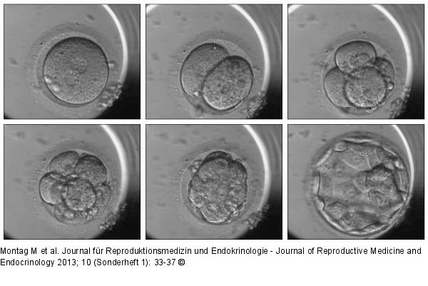 Series of time-lapse images