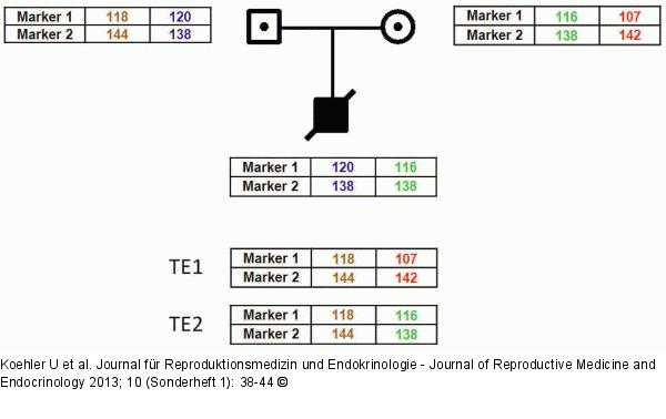 PGD for Spinal Muscular Atrophy, SMA