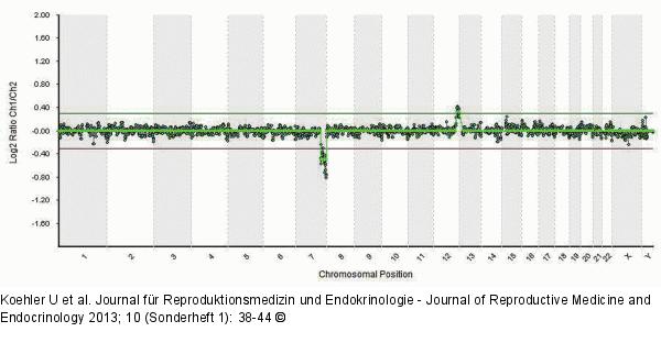 Array CGH profile