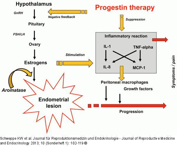 Progestins for endometriosis
